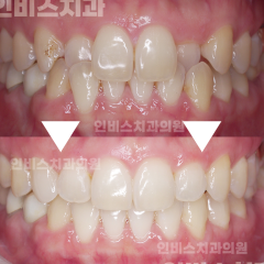 블로그 1