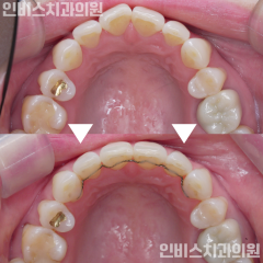 블로그 2
